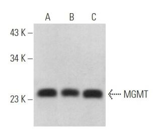 MGMT Antibody (D-4) - Western Blotting - Image 372358 