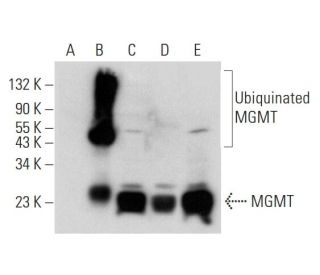 MGMT Antibody (G-10) - Western Blotting - Image 318021 