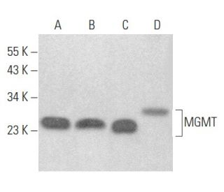 MGMT Antibody (MT5.1) - Western Blotting - Image 355209 