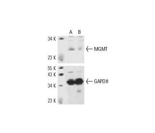 MGMT siRNA (h): sc-35927. Western blot analysis of MGMT expression in non-transfected control (A) and MGMT siRNA transfect 