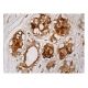 MGP Antibody (H-4) - Immunohistochemistry - Image 161039 