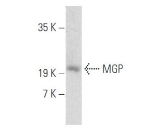 MGP Antibody (H-4) - Western Blotting - Image 356083 