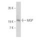 MGP Antibody (H-4) - Western Blotting - Image 356083 