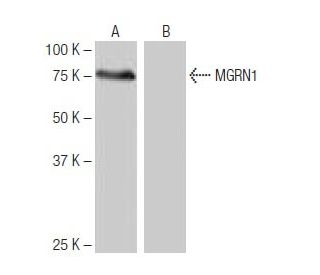 MGRN1 Antibody (LM-1A33) - Western Blotting - Image 64996 