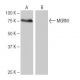 MGRN1 Antibody (LM-1A33) - Western Blotting - Image 64996 