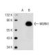 MGRN1 Antibody (LM-1A33) - Western Blotting - Image 109628
