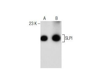 MH-S Whole Cell Lysate: sc-364785. Western blot analysis of SLPI... 