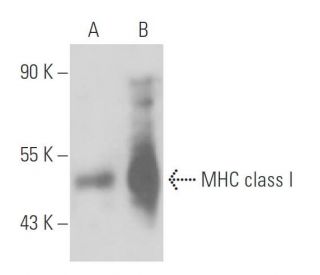 MHC class I Antibody (ER-HR52) - Western Blotting - Image 17059