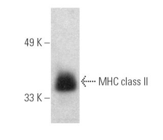 MHC class II Antibody (ER-TR3) - Western Blotting - Image 389837