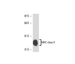 MHC class II Antibody (IBL-5/22) - Western Blotting - Image 16225