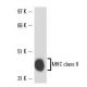MHC class II Antibody (IBL-5/22) - Western Blotting - Image 16225