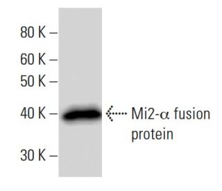 Mi2-&alpha; Antibody (2172C1a) - Western Blotting - Image 16698