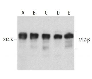 Mi2-&beta; Antibody (F-7) - Western Blotting - Image 398985 