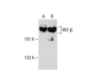 Mi2-&beta; Antibody (H-8) - Western Blotting - Image 150006 