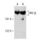 Mi2-β Antibody (H-8) - Western Blotting - Image 150006 
