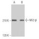 Mi2-β Antibody (H-8) - Western Blotting - Image 363605