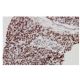 Mi2-β Antibody (SW-88) - Immunohistochemistry - Image 64997 