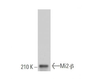 Mi2-β Antibody (F-7) - Western Blotting - Image 363604