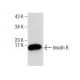Insulin B Antibody (C-12) - Western Blotting - Image 282020