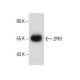 ZPR1 Antibody (D-3) - Western Blotting - Image 286117 