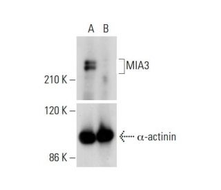 MIA3 HDR Plasmid (h): sc-403994-HDR. Western blot analysis of MIA3 expression in non-transfected control(A) and puromycinEach CRISPR/Cas9 Knockout (KO) Plasmid product consists of a pool of 3 plasmids designed to ensure identification and cleavage of a specific gene for maximum knockout efficiency. Each plasmid encodes a unique 20 nt sequence derived from the GeCKO (v2) library.