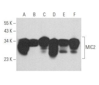 MIC2 Antibody (12E7) - Western Blotting - Image 357748 
