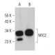 MIC2 Antibody (F-8) - Western Blotting - Image 363739 