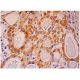 MICA/B Antibody (D-8) - Immunohistochemistry - Image 285708