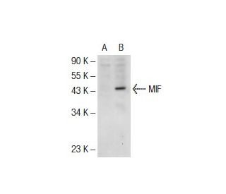 MIF Antibody (11) - Western Blotting - Image 72578