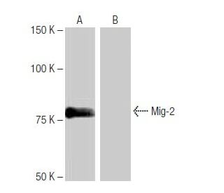 Mig-2 Antibody (NQ-A16) - Western Blotting - Image 65000SAM Transcription Activation: SAM system utilizing dCas9-VP64, MS2-P65-HSF1, and sgRNA for precise gene transcription activation.
