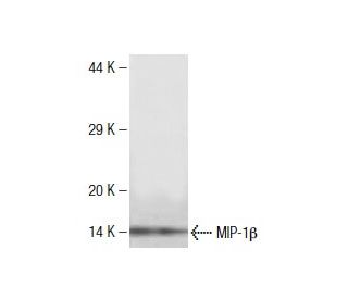 MIP-1&beta; Antibody (3H3) - Western Blotting - Image 136765Each CRISPR/Cas9 Knockout (KO) Plasmid product consists of a pool of 3 plasmids designed to ensure identification and cleavage of a specific gene for maximum knockout efficiency. Each plasmid encodes a unique 20 nt sequence derived from the GeCKO (v2) library. 