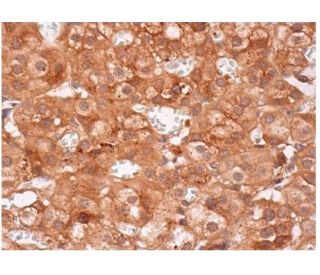 MIP-1&alpha; Antibody (D-3) - Immunohistochemistry - Image 284834 