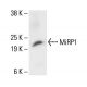 MiRP1 Antibody (H-4) - Western Blotting - Image 411815
