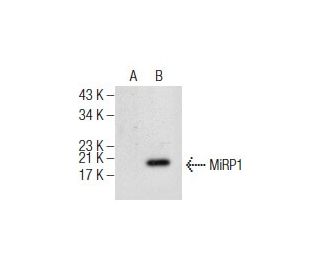 MiRP1 Antibody (H-4) - Western Blotting - Image 155417Each CRISPR/Cas9 Knockout (KO) Plasmid product consists of a pool of 3 plasmids designed to ensure identification and cleavage of a specific gene for maximum knockout efficiency. Each plasmid encodes a unique 20 nt sequence derived from the GeCKO (v2) library.