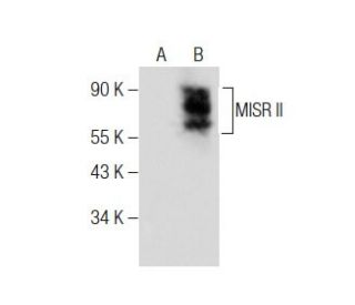 MISR II Antibody (D-9) - Western Blotting - Image 284483The Double Nickase Plasmid features a U6 promoter for sgRNA expression, a 20 nt targeting sequence, and a gRNA scaffold to guide Cas9n. It includes a CBh promoter for Cas9n (D10A) and puromycin resistance, GFP for transfection verification, and nuclear localization signals (NLS). The 2A peptide allows co-expression of Cas9n and Puro from a single promoter, enabling precise genome editing with reduced off-target effects.