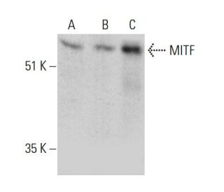 MITF Antibody (D-9) - Western Blotting - Image 387366Each CRISPR/Cas9 Knockout (KO) Plasmid product consists of a pool of 3 plasmids designed to ensure identification and cleavage of a specific gene for maximum knockout efficiency. Each plasmid encodes a unique 20 nt sequence derived from the GeCKO (v2) library.