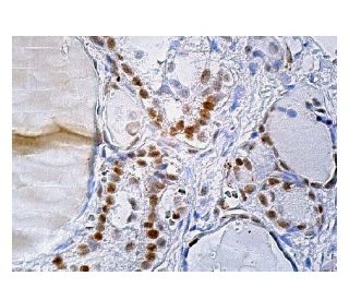 MLF2 Antibody (B-1) - Immunohistochemistry - Image 159529 