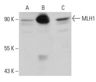 MLH1 Antibody (Clone 14) - Western Blotting - Image 20138