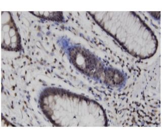 MLKL Antibody (3B2) - Immunohistochemistry - Image 346156 