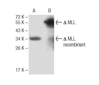 MLL Antibody (10F8D7) - Western Blotting - Image 137458