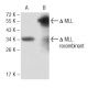 MLL Antibody (10F8D7) - Western Blotting - Image 137458