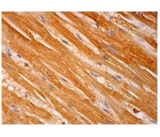 MLN64 Antibody (G-3) - Immunohistochemistry - Image 293706 