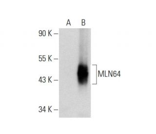 MLN64 Antibody (H-1) - Western Blotting - Image 72926 