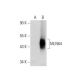 MLN64 Antibody (H-1) - Western Blotting - Image 72926 