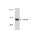 Notch 1 (M-20): sc-6015. Western blot analysis of Notch 1 expression in MM-142 whole cell lysate.