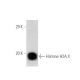 MM-142 nuclear extract: sc-2139. Western blot analysis of Histone H2A.X... 