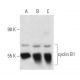 MM-142 + PMA nuclear extract: sc-2140. Western blot analysis of...