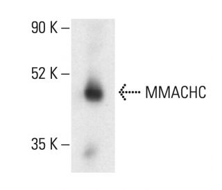 MMACHC Antibody (B-5) - Western Blotting - Image 404064 