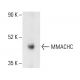 MMACHC Antibody (B-5) - Western Blotting - Image 404066