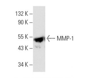 MMP-1 Antibody (3B6) - Western Blotting - Image 3843